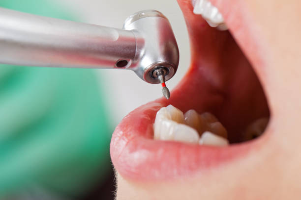 Best Knocked-Out Tooth Emergency  in Circleville, OH